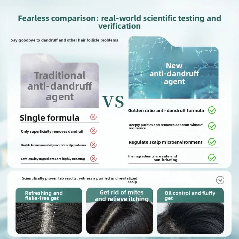Selenium Sulfide Anti-Dandruff Shampoo