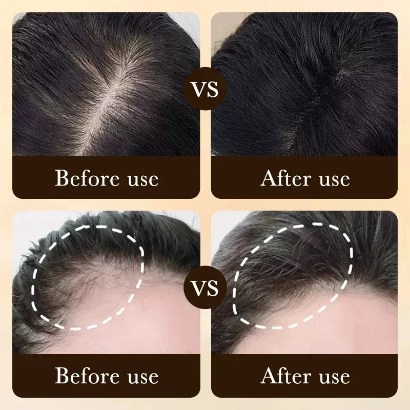 Biotin Hair Growth Scalp Serum