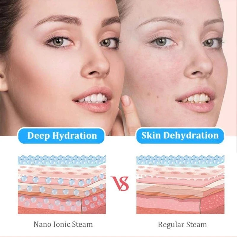 Diamond Microdermabrasion & Vacuum Pore Cleaner