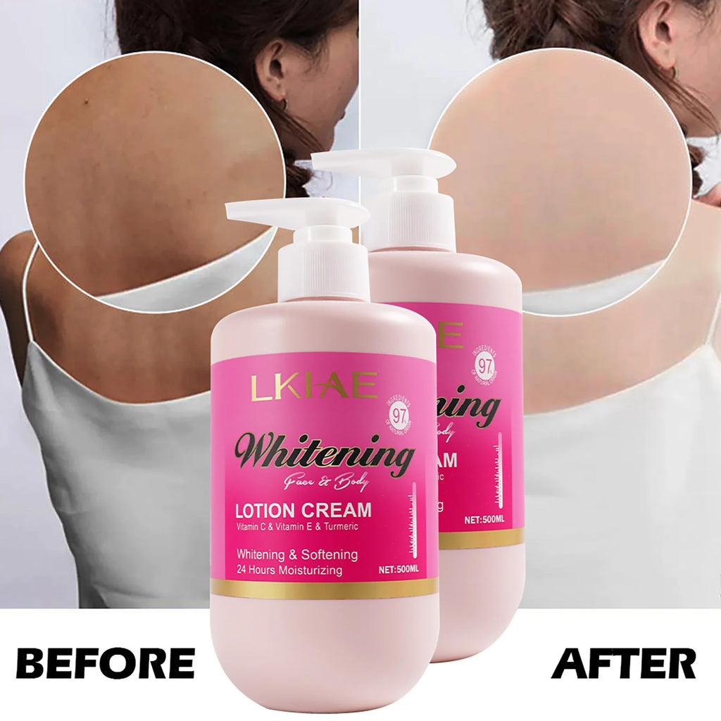 Vitamin C, E & Turmeric Body Lotion