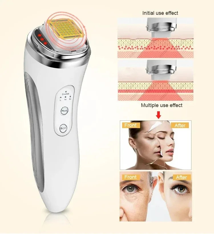 Electric Facial Lifting Device — Dot Matrix Warming Tool
