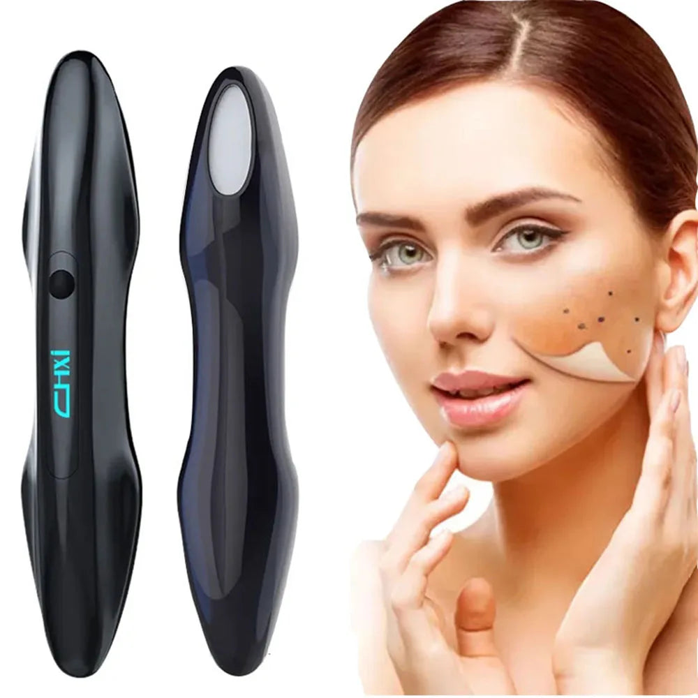 Clarity Pen — Ozone & Cold Plasma Facial Device